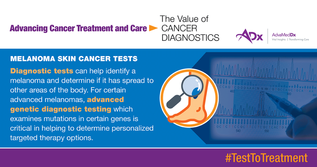 From Test To Treatment The Value Of Cancer Diagnostics Graphic melanoma skin cancer tests