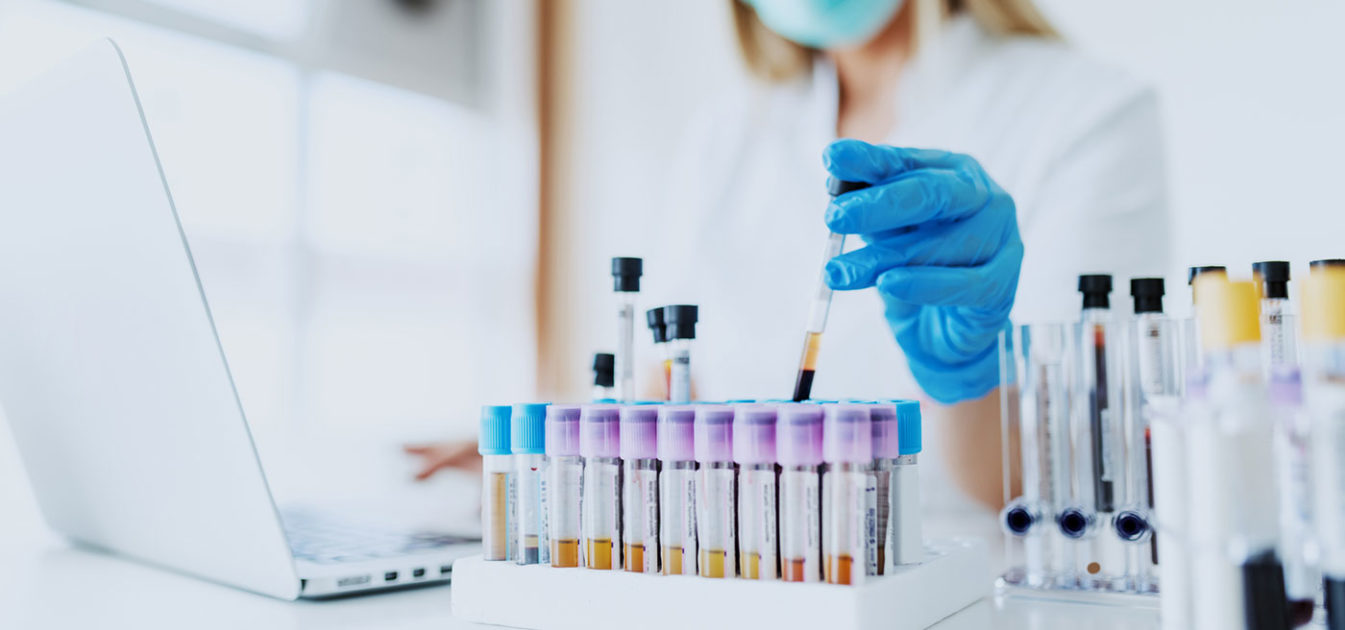 technician pulls a vial from a collection