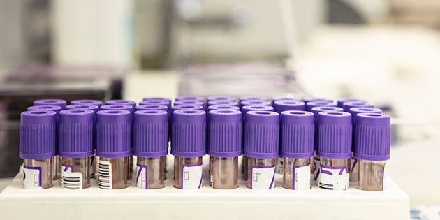 test vials with purple caps