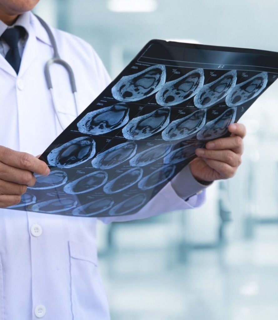 Doctor reviewing a patient's MRI scan