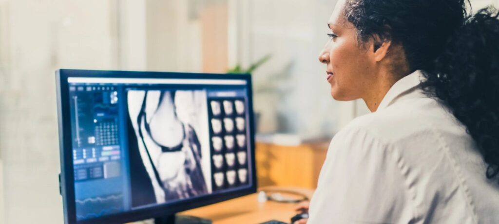 woman in a lab coat looking at xray scan on a computer screen